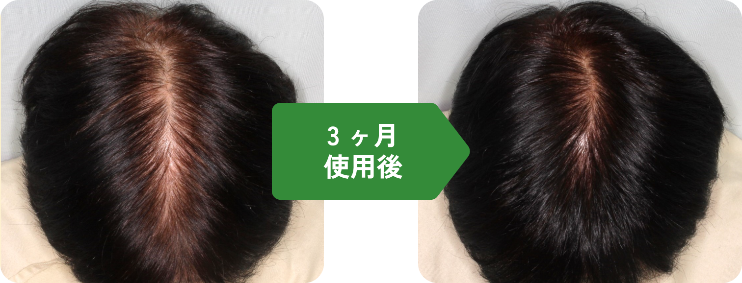 3ヶ月使用後イメージ