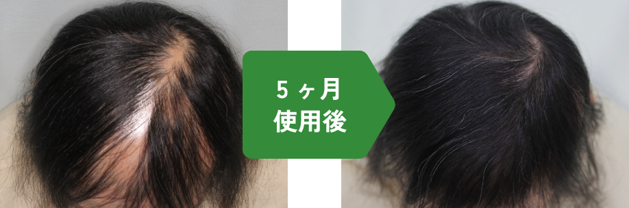 5ヶ月使用後イメージ