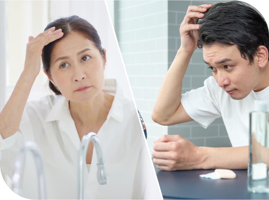 薄毛イメージ