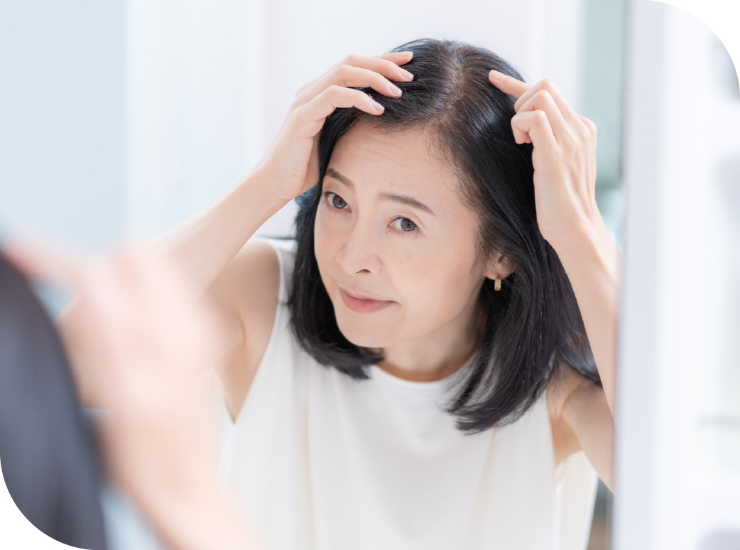 女性の薄毛イメージ